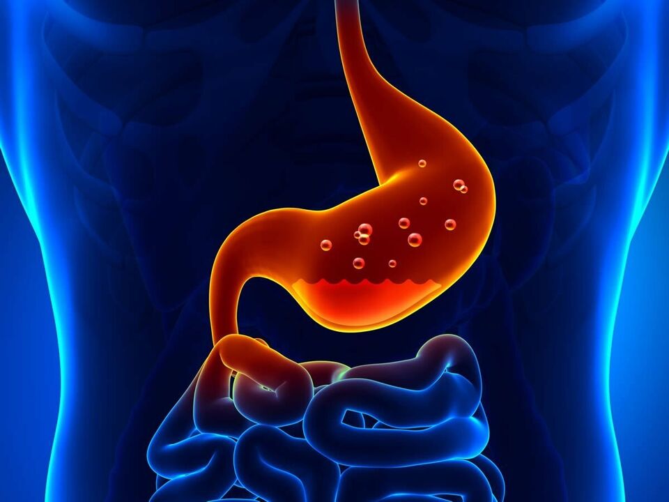 Gastritis ist eine entzündliche Erkrankung des Magens, die erfordert